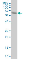 Western blot of CBS expression in HeLa cell lysate.