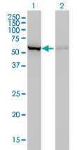 Western blot of CBS expression in transfected 293T cell line. Lane 1: CBS transfected lysate (61 KDa). Lane 2: Non-transfected lysate.