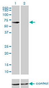 Western blot of CBS over-expressed 293 cell line, cotransfected with CBS Validated Chimera RNAi (Lane 2) or non-transfected control (Lane 1). Blot probed with CBS antibody, clone 3E1. GAPDH ( 36.1 kD ) used as specificity and loading control.