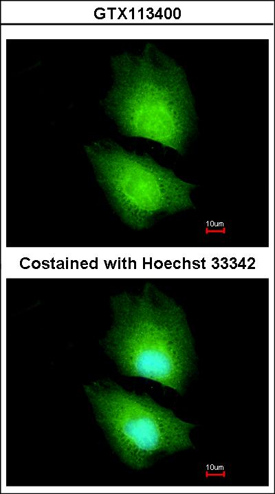 Immunofluorescence of paraformaldehyde-fixed HeLa using CBS antibody at 1:200 dilution.
