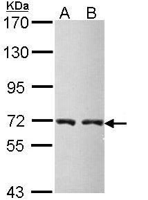 Sample (30 ug of whole cell lysate). A: Molt-4 , B: Raji. 7.5% SDS PAGE. CBS antibody diluted at 1:5000.