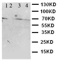 WB of CBS antibody. Lane 1: SMMC Cell Lysate. Lane 2: U87 Cell Lysate. Lane 3: HELA Cell Lysate. Lane 4: M231 Cell Lysate.
