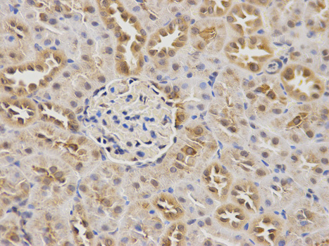 Immunohistochemistry of paraffin-embedded rat kidney using CBS antibody at dilution of 1:100 (400x lens).