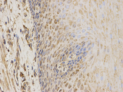 Immunohistochemistry of paraffin-embedded human esophagus using CBS antibody at dilution of 1:100 (400x lens).