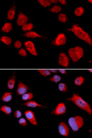 Immunofluorescence analysis of U2OS cell using CBS antibody. Blue: DAPI for nuclear staining.