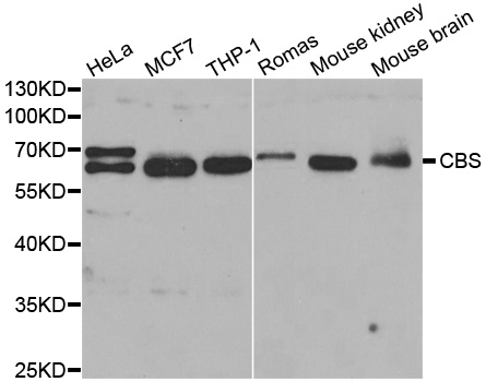 Western blot analysis of extracts of various cell lines, using CBS antibody.