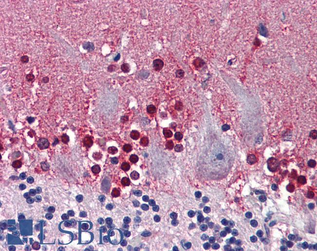 Anti-CBS antibody IHC of human brain, cerebellum. Immunohistochemistry of formalin-fixed, paraffin-embedded tissue after heat-induced antigen retrieval. Antibody LS-B6018 concentration 5 ug/ml.