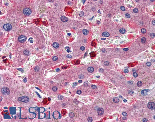 Anti-CBS antibody IHC of human liver. Immunohistochemistry of formalin-fixed, paraffin-embedded tissue after heat-induced antigen retrieval. Antibody LS-B6019 concentration 5 ug/ml.