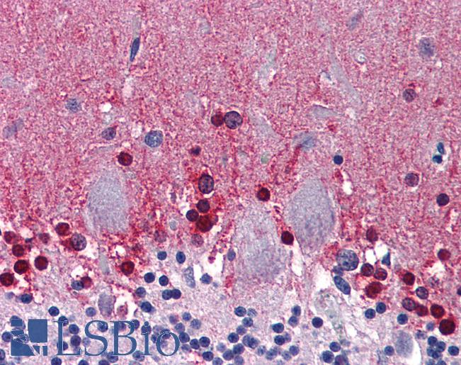 Anti-CBS antibody IHC of human brain, cerebellum. Immunohistochemistry of formalin-fixed, paraffin-embedded tissue after heat-induced antigen retrieval. Antibody LS-B6019 concentration 5 ug/ml.