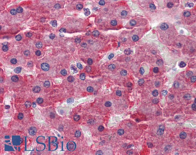 Anti-CBS antibody IHC of human liver. Immunohistochemistry of formalin-fixed, paraffin-embedded tissue after heat-induced antigen retrieval. Antibody LS-B6017 concentration 5 ug/ml.