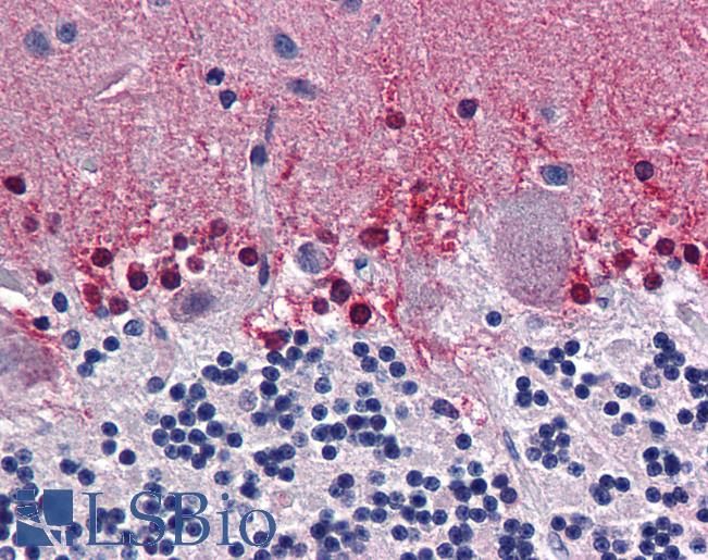Anti-CBS antibody IHC of human brain, cerebellum. Immunohistochemistry of formalin-fixed, paraffin-embedded tissue after heat-induced antigen retrieval. Antibody LS-B6017 concentration 5 ug/ml.