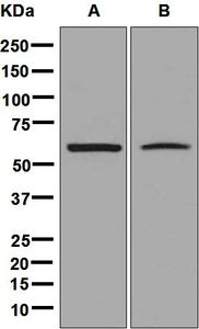 Western blot analysis on (A) fetal liver and (B) Raji cell lysates using anti-CBS antibody.