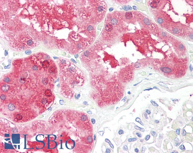 Anti-CBT1 / SDHD antibody IHC staining of human kidney. Immunohistochemistry of formalin-fixed, paraffin-embedded tissue after heat-induced antigen retrieval.