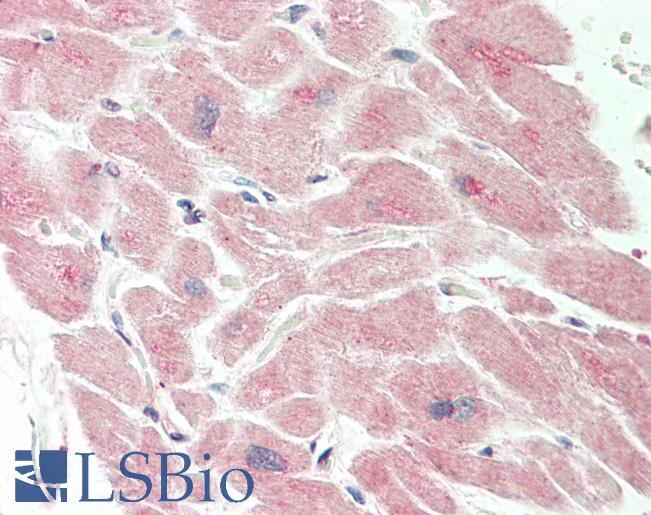 Human Heart: Formalin-Fixed, Paraffin-Embedded (FFPE)