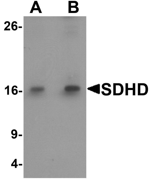 Western blot analysis of SDHD in EL4 cell lysate with SDHD antibody at (A) 1 and (B) 2 ug/ml.