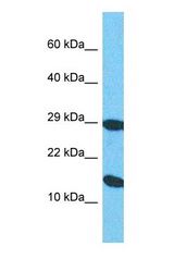 Western blot of SDHD Antibody with human HepG2 Whole Cell lysate.