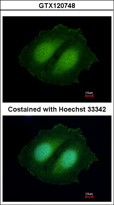 Immunofluorescence of methanol-fixed MCF-7, using CBWD1 antibody at 1:500 dilution.
