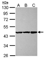 Sample (30 ug of whole cell lysate) A: NT2D1 B: IMR32 C: U87-MG 10% SDS PAGE CBWD1 antibody diluted at 1:1000