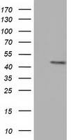 HEK293T cells were transfected with the pCMV6-ENTRY control (Left lane) or pCMV6-ENTRY CBWD1 (Right lane) cDNA for 48 hrs and lysed. Equivalent amounts of cell lysates (5 ug per lane) were separated by SDS-PAGE and immunoblotted with anti-CBWD1.