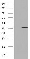 HEK293T cells were transfected with the pCMV6-ENTRY control (Left lane) or pCMV6-ENTRY CBWD1 (Right lane) cDNA for 48 hrs and lysed. Equivalent amounts of cell lysates (5 ug per lane) were separated by SDS-PAGE and immunoblotted with anti-CBWD1.