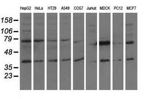 Western blot of extracts (35 ug) from 9 different cell lines by using anti-CBWD1 monoclonal antibody.