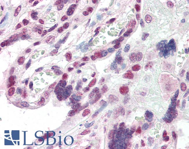 Anti-CBX1 antibody IHC of human placenta. Immunohistochemistry of formalin-fixed, paraffin-embedded tissue after heat-induced antigen retrieval. Antibody LS-B2395 concentration 5 ug/ml.