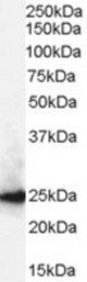 Antibody (0.3 ug/ml) staining of A431 lysate (35 ug protein in RIPA buffer). Primary incubation was 1 hour. Detected by chemiluminescence.