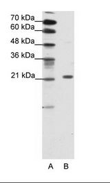 A: Marker, B: HepG2 Cell Lysate