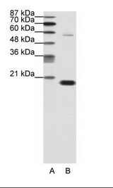 A: Marker, B: Jurkat Cell Lysate