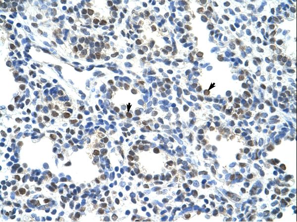 CBX3 antibody LS-C31773 was used in IHC to stain formalin-fixed, paraffin-embedded human lung.