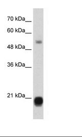 Jurkat Cell Lysate