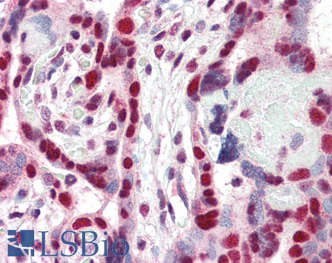 Anti-CBX3 antibody IHC of human placenta. Immunohistochemistry of formalin-fixed, paraffin-embedded tissue after heat-induced antigen retrieval. Antibody LS-B2396 concentration 5 ug/ml.