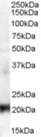 (0.3 ug/ml) Staining of A431 lysate (35 ug protein in RIPA buffer). Primary incubation was 1 hour. Detected by chemiluminescence.