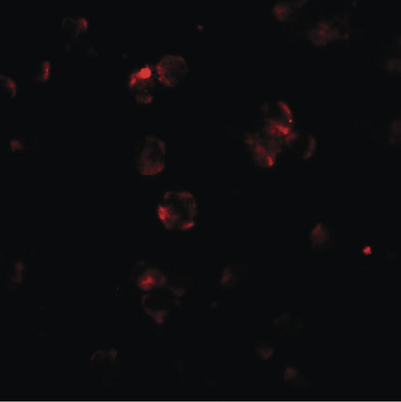 Immunofluorescence of ABCA7 in 293 cells with ABCA7 antibody at 20 ug/ml.