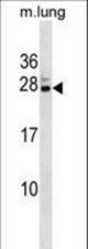 Mouse Cbx5 Antibody western blot of mouse lung tissue lysates (35 ug/lane). The Cbx5 antibody detected the Cbx5 protein (arrow).