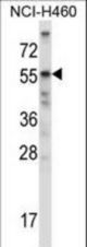 Mouse Acvr2b Antibody western blot of NCI-H460 cell line lysates (35 ug/lane). The Acvr2b antibody detected the Acvr2b protein (arrow).