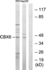Western blot of extracts from 293/HepG2 cells, using CBX6 Antibody. The lane on the right is treated with the synthesized peptide.