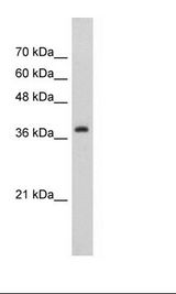 Jurkat Cell Lysate