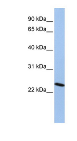 CBX7 antibody LS-C109917 Western blot of HepG2 cell lysate.