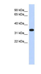 ACTRT1 antibody LS-C102434 Western blot of Fetal Pancreas lysate.
