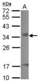 Sample (30 ug of whole cell lysate) A: HeLa 12% SDS PAGE CBX7 antibody diluted at 1:1000