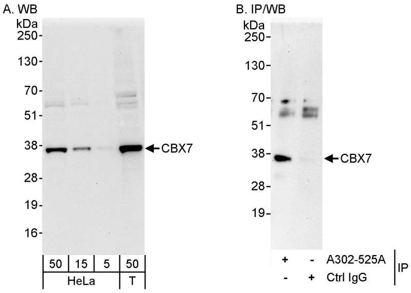 Detection of Human CBX7 by Western Blot and Immunoprecipitation. Samples: Whole cell lysate from HeLa (5, 15 and 50 ug for WB; 1 mg for IP, 20% of IP loaded) and 293T (T; 50 ug) cells. Antibodies: Affinity purified rabbit anti-CBX7 antibody used for WB at 0.04 ug/ml (A) and 1 ug/ml (B) and used for IP at 10 ug/mg lysate. Detection: Chemiluminescence with exposure times of 10 seconds (A) and 30 seconds (B).