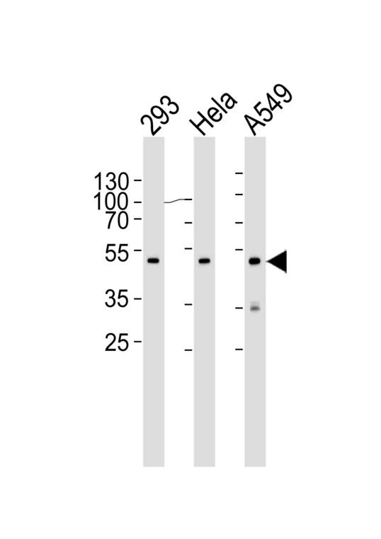 Western blot of lysates from 293, HeLa, A549 cell line (from left to right) with CBX8 Antibody. Antibody was diluted at 1:1000 at each lane. A goat anti-mouse IgG H&L (HRP) at 1:3000 dilution was used as the secondary antibody. Lysates at 35 ug per lane.