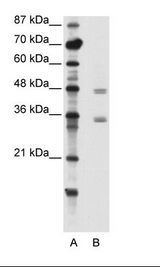A: Marker, B: Jurkat Cell Lysate