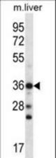 CBX8 Antibody western blot of mouse liver tissue lysates (35 ug/lane). The CBX8 antibody detected the CBX8 protein (arrow).