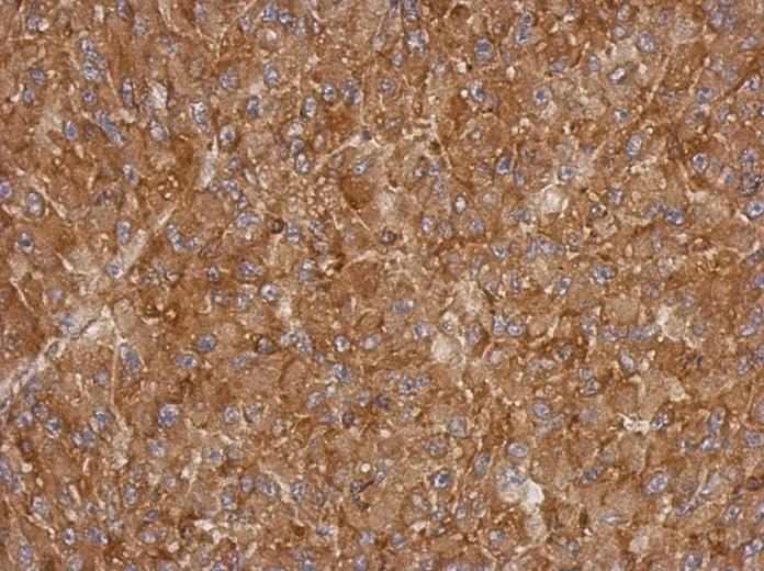 IHC of paraffin-embedded U87 xenograft, using ACTRT1 antibody at 1:500 dilution.