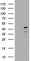 HEK293T cells were transfected with the pCMV6-ENTRY control (Left lane) or pCMV6-ENTRY CBX8 (Right lane) cDNA for 48 hrs and lysed. Equivalent amounts of cell lysates (5 ug per lane) were separated by SDS-PAGE and immunoblotted with anti-CBX8.