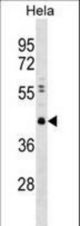 CBX8 Antibody (Y321) western blot of HeLa cell line lysates (35 ug/lane). The CBX8 antibody detected the CBX8 protein (arrow).