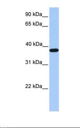 Fetal muscle lysate. Antibody concentration: 1.0 ug/ml. Gel concentration: 12%.