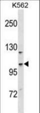 CC2D1A Antibody western blot of K562 cell line lysates (35 ug/lane). The CC2D1A antibody detected the CC2D1A protein (arrow).
